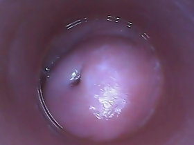 膣