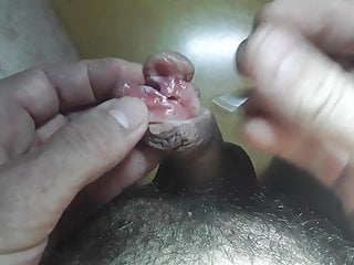 ピアスとsubincision
